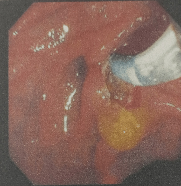 PMC12006735 – FIG4