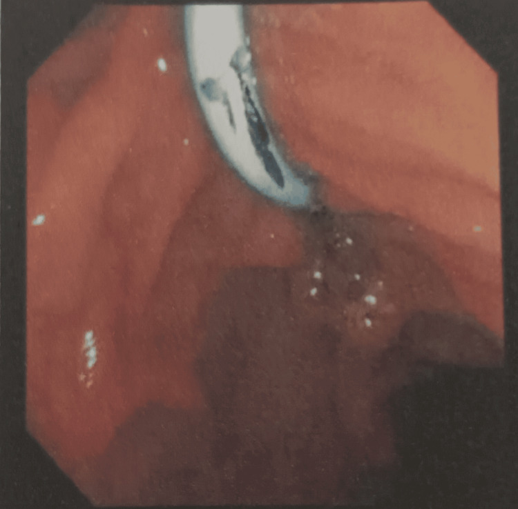 PMC12006735 – FIG5