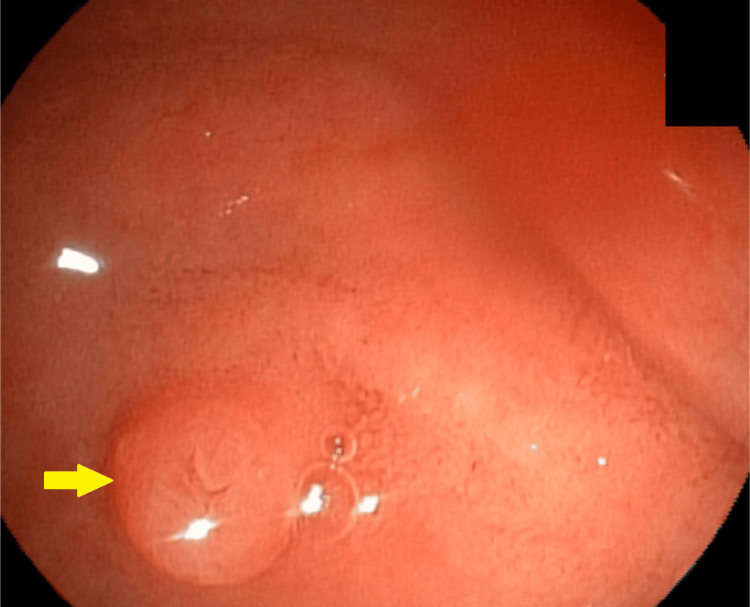 PMC12082747 – FIG1
