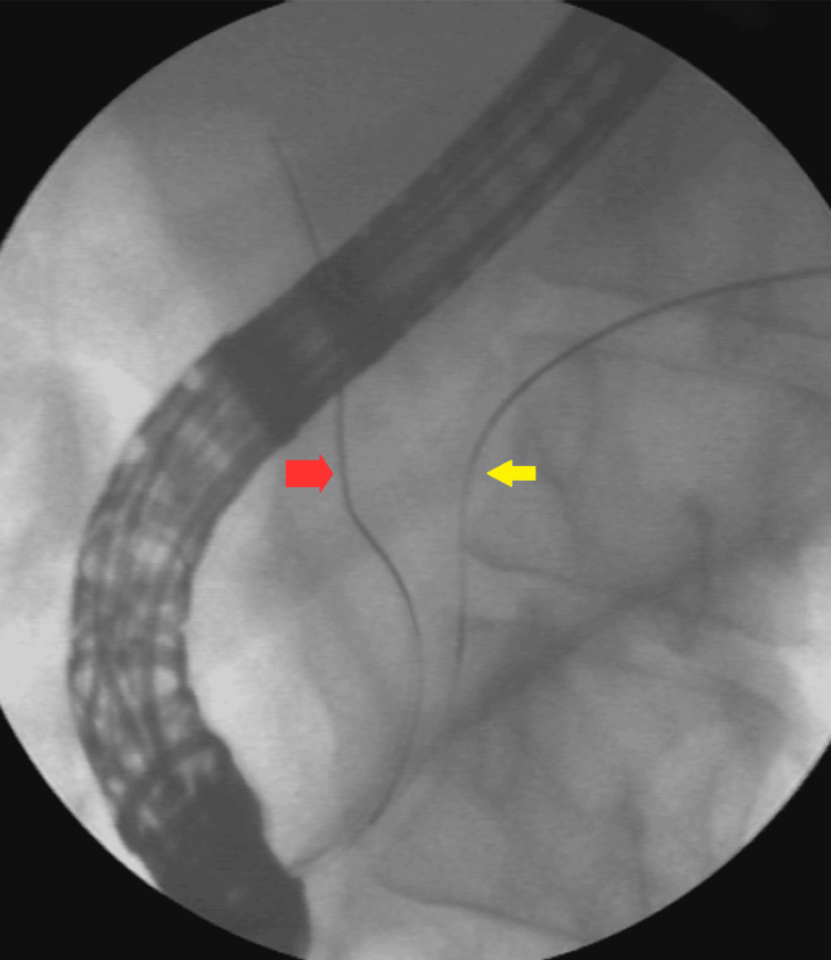 PMC12082747 – FIG2