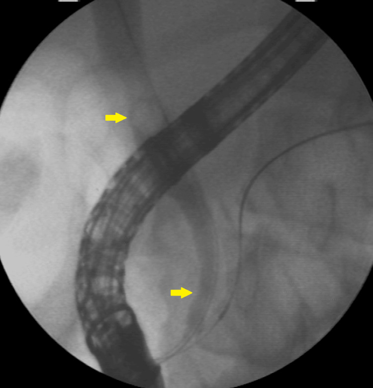 PMC12082747 – FIG3