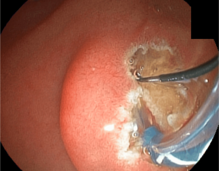 PMC12082747 – FIG4