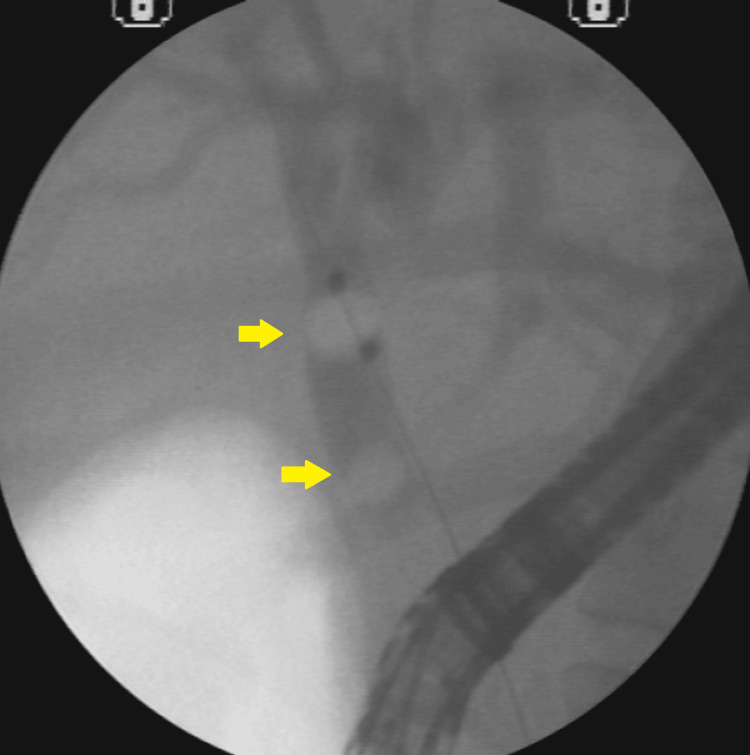 PMC12082747 – FIG6