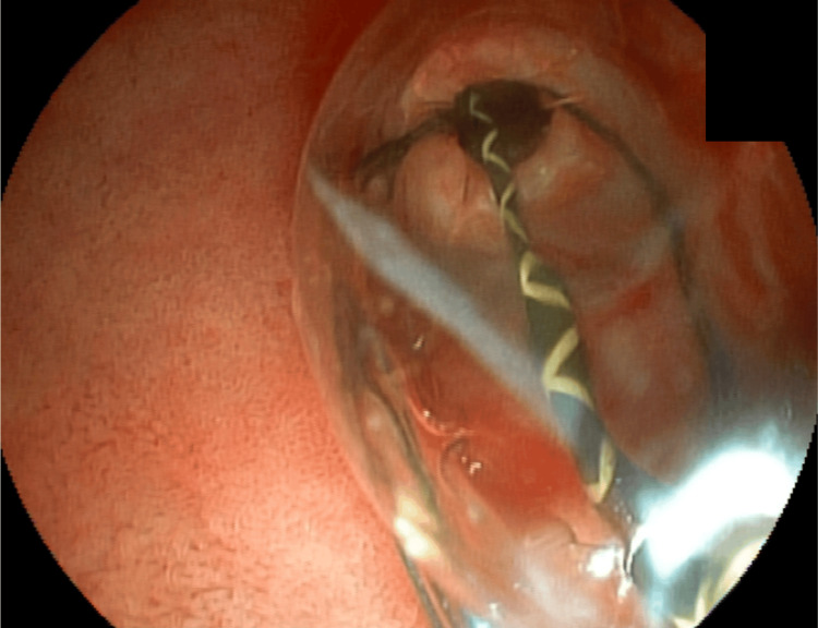 PMC12082747 – FIG9