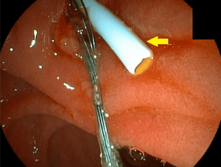 PMC12082747 – FIG10