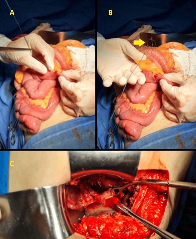 PMC12082747 – FIG11