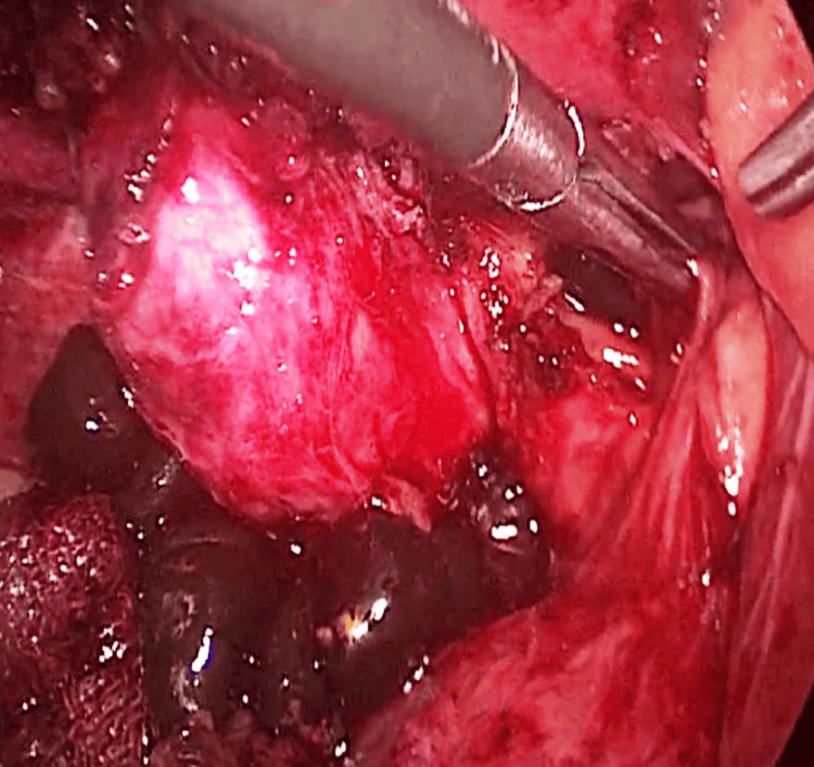 PMC12100571 – FIG2