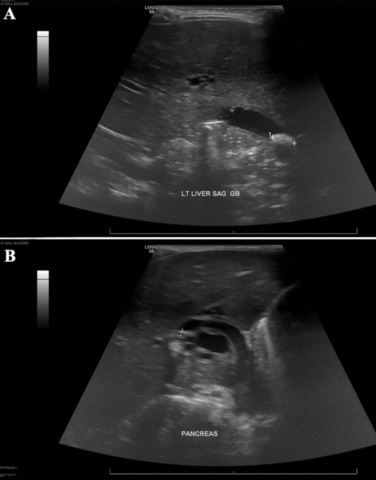 PMC12130344 – FIG3