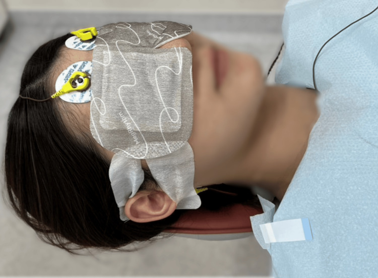 PMC12176454 – FIG2