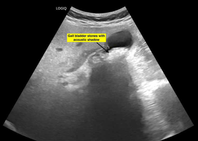 PMC12254048 – FIG1