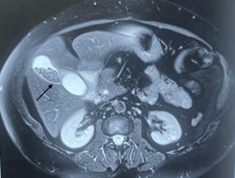 PMC12254048 – FIG2