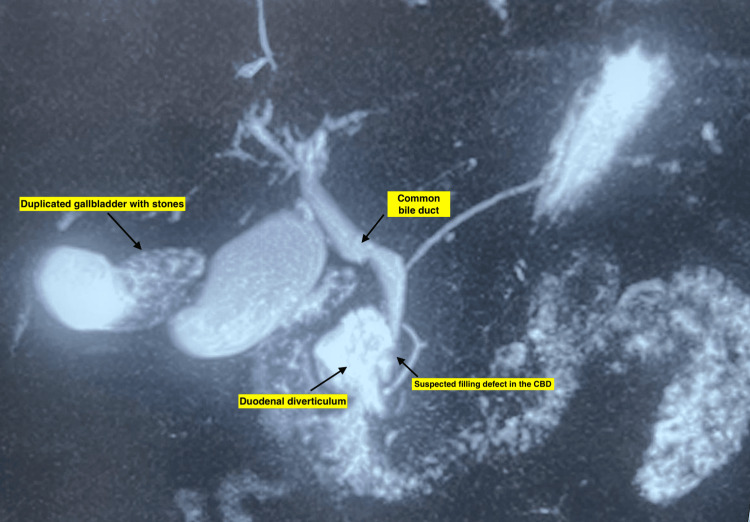 PMC12254048 – FIG3
