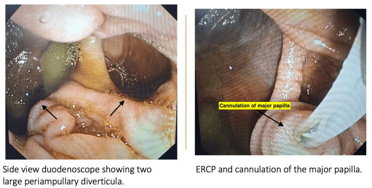 PMC12254048 – FIG4