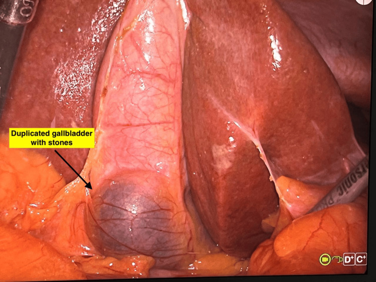 PMC12254048 – FIG5