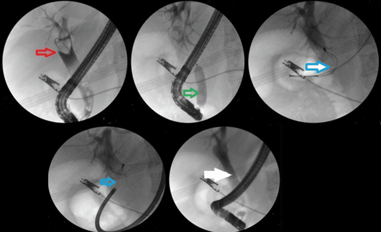 PMC12306517 – FIG3