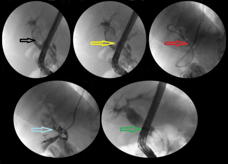 PMC12306517 – FIG4