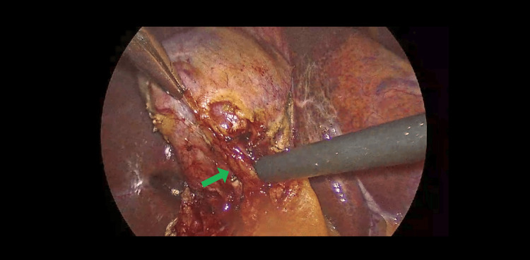 PMC12399276 – FIG1