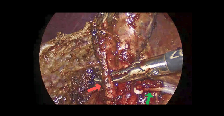 PMC12399276 – FIG2