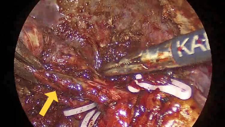 PMC12399276 – FIG3