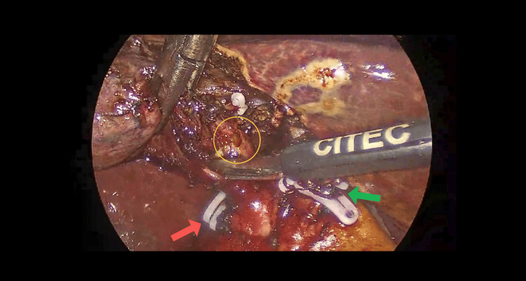 PMC12399276 – FIG4