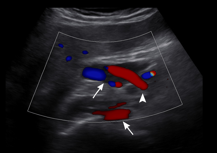 PMC12378366 – FIG1
