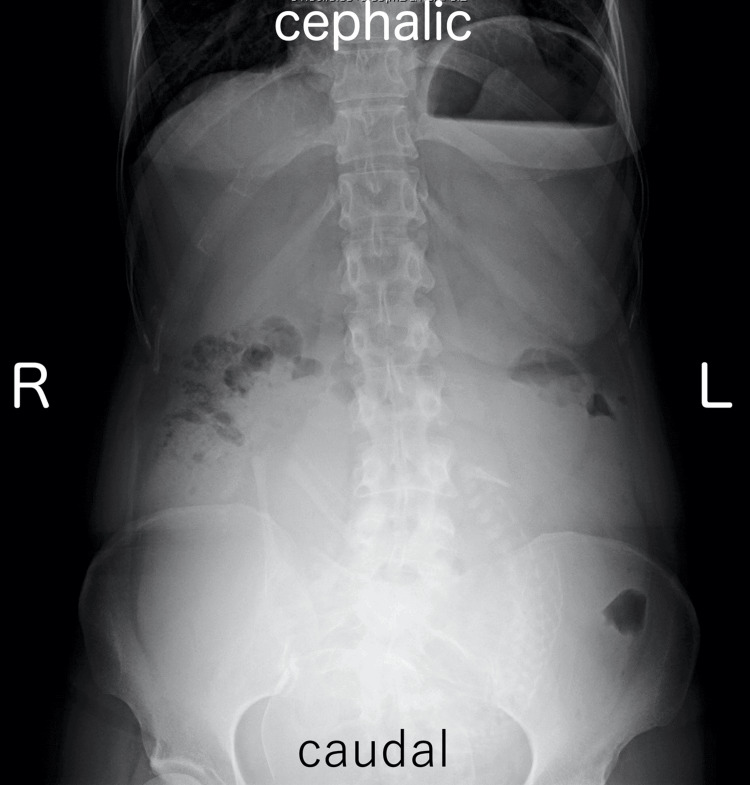 PMC12615350 – FIG2