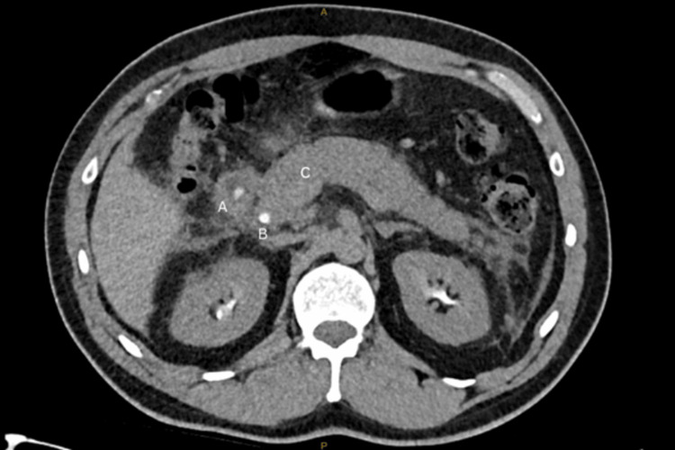 PMC12620036 – FIG2