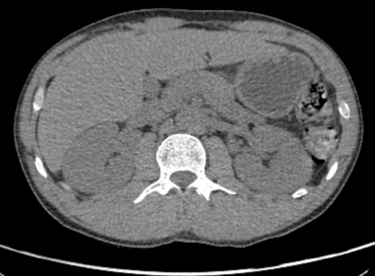 PMC12925600 – FIG2
