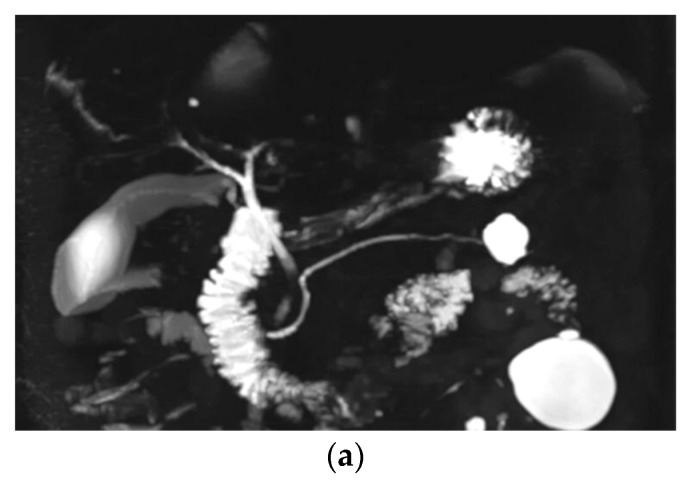 PMC7345120 – diagnostics-10-00376-f002