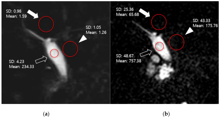 PMC8065789 – diagnostics-11-00634-f001