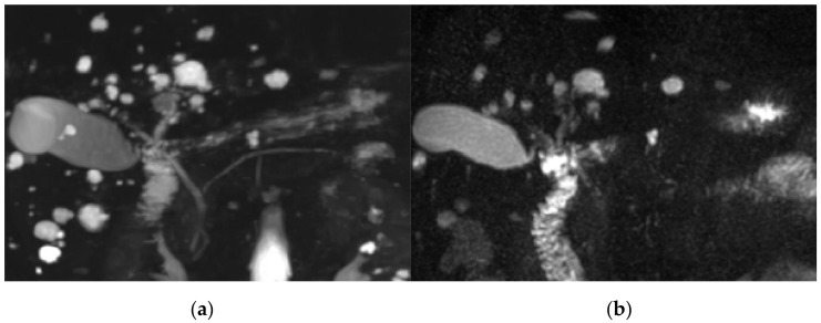 PMC8065789 – diagnostics-11-00634-f002