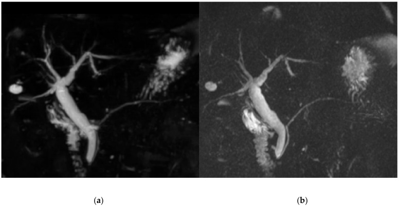 PMC8065789 – diagnostics-11-00634-f003