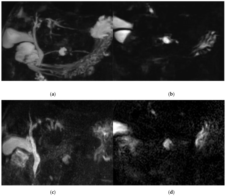 PMC8065789 – diagnostics-11-00634-f004