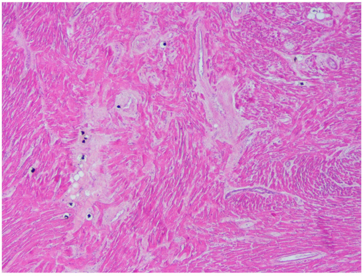 PMC8156818 – diagnostics-11-00886-f005