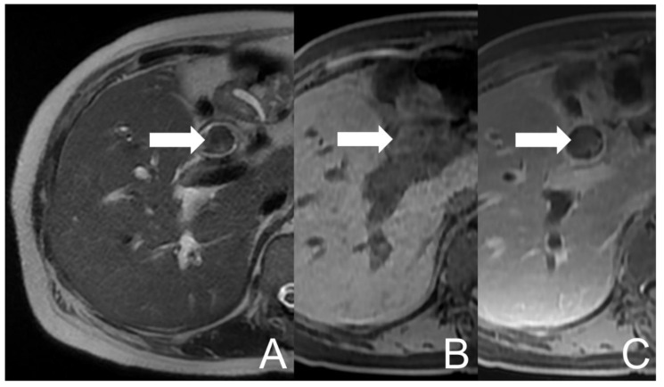 PMC9324465 – diagnostics-12-01517-f001