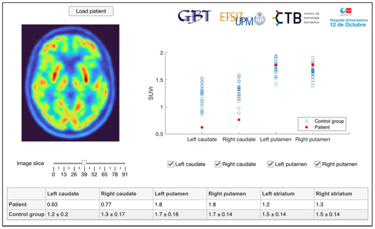 PMC9818161 – diagnostics-13-00006-f001