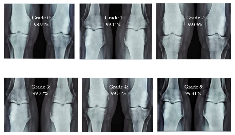 PMC10137623 – diagnostics-13-01385-f005