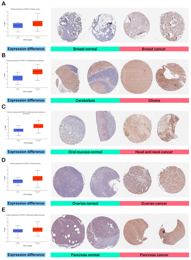 PMC10178510 – diagnostics-13-01613-f002