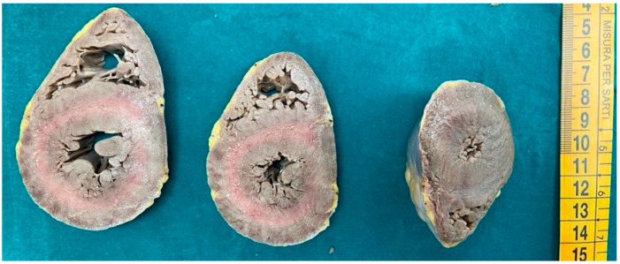 PMC12026069 – diagnostics-15-00999-f001