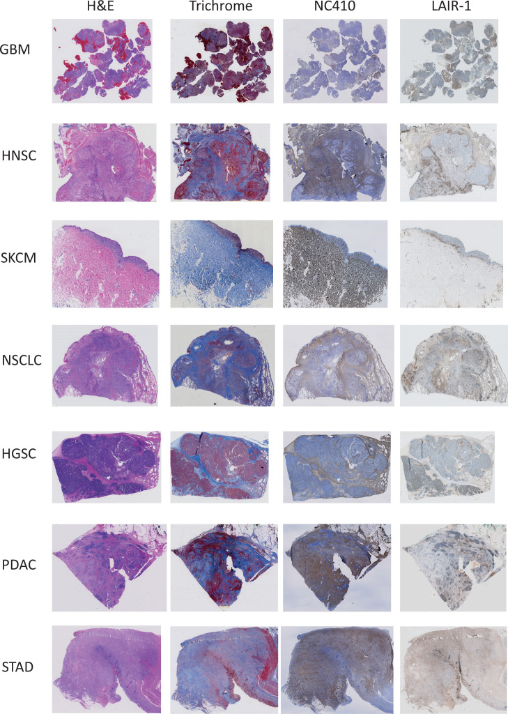 PMC8225389 – fig7s2