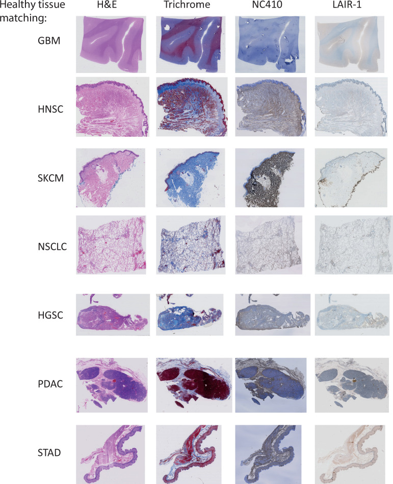 PMC8225389 – fig7s3