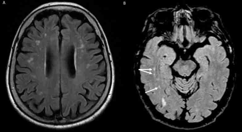 PMC12738272 – S3.F3