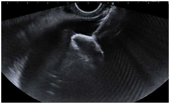 PMC10753828 – fig1