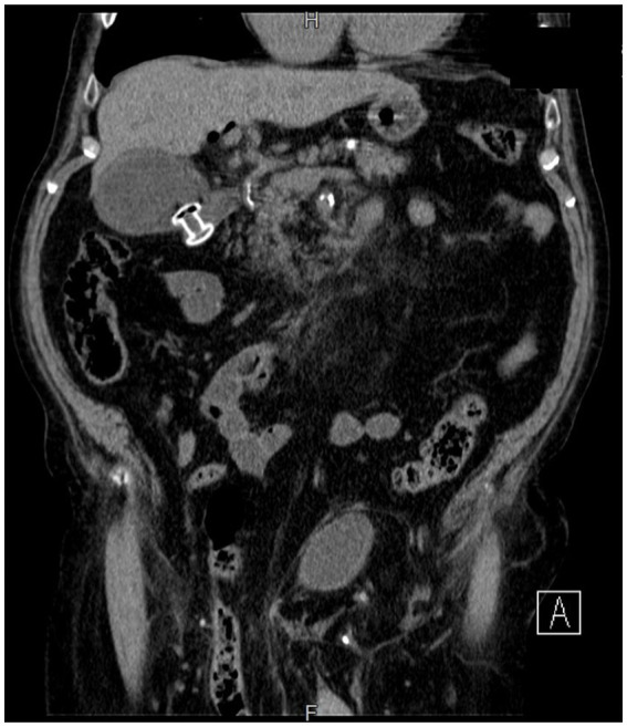PMC10753828 – fig2