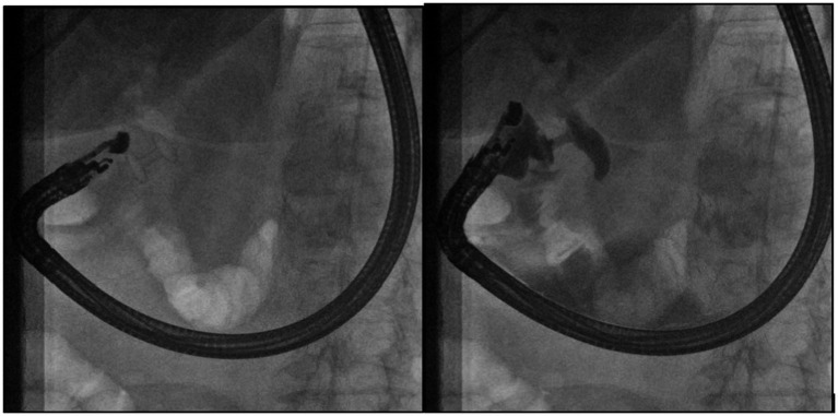 PMC10753828 – fig3