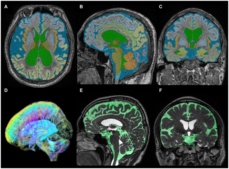 PMC10978765 – fig1