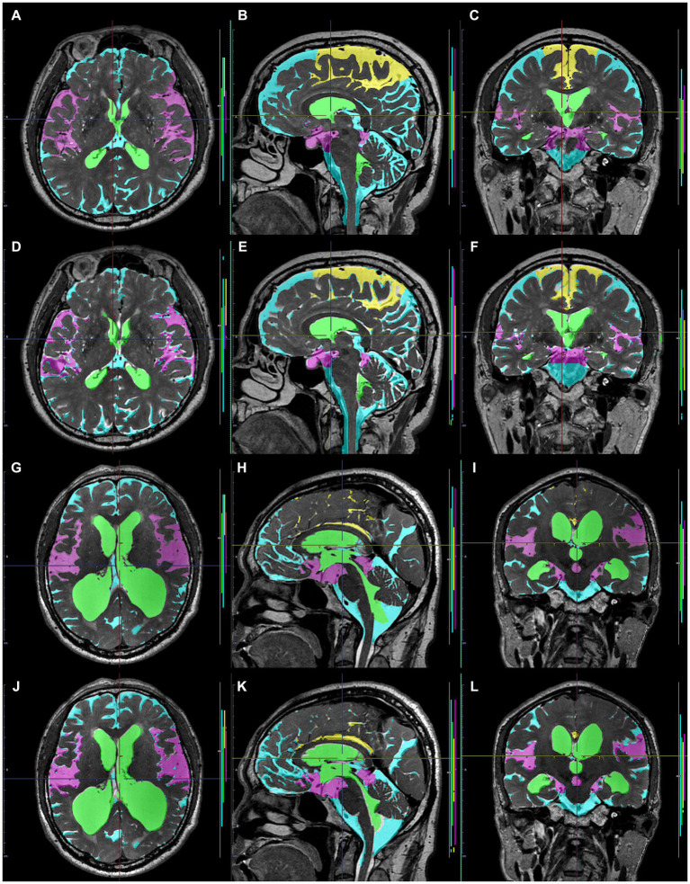 PMC10978765 – fig9