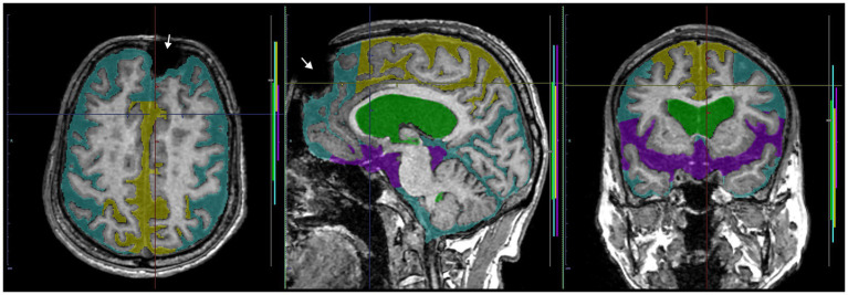 PMC10978765 – fig10