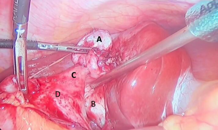 PMC11375240 – f0005