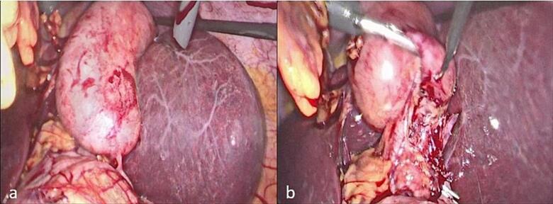 PMC10831892 – f0005